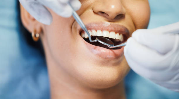 Best Emergency Treatment for Dental Infections or Abscesses in Bethany, OR